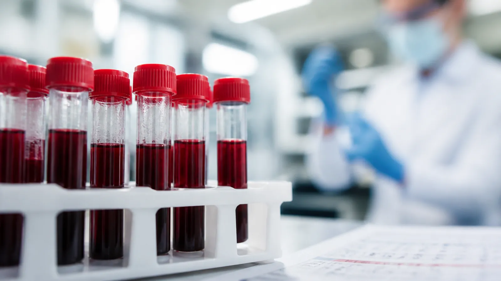 Anonymised blood sample tubes beside a blurred laboratory reference chart