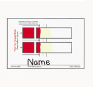 Blood drops being applied to the collection card squares