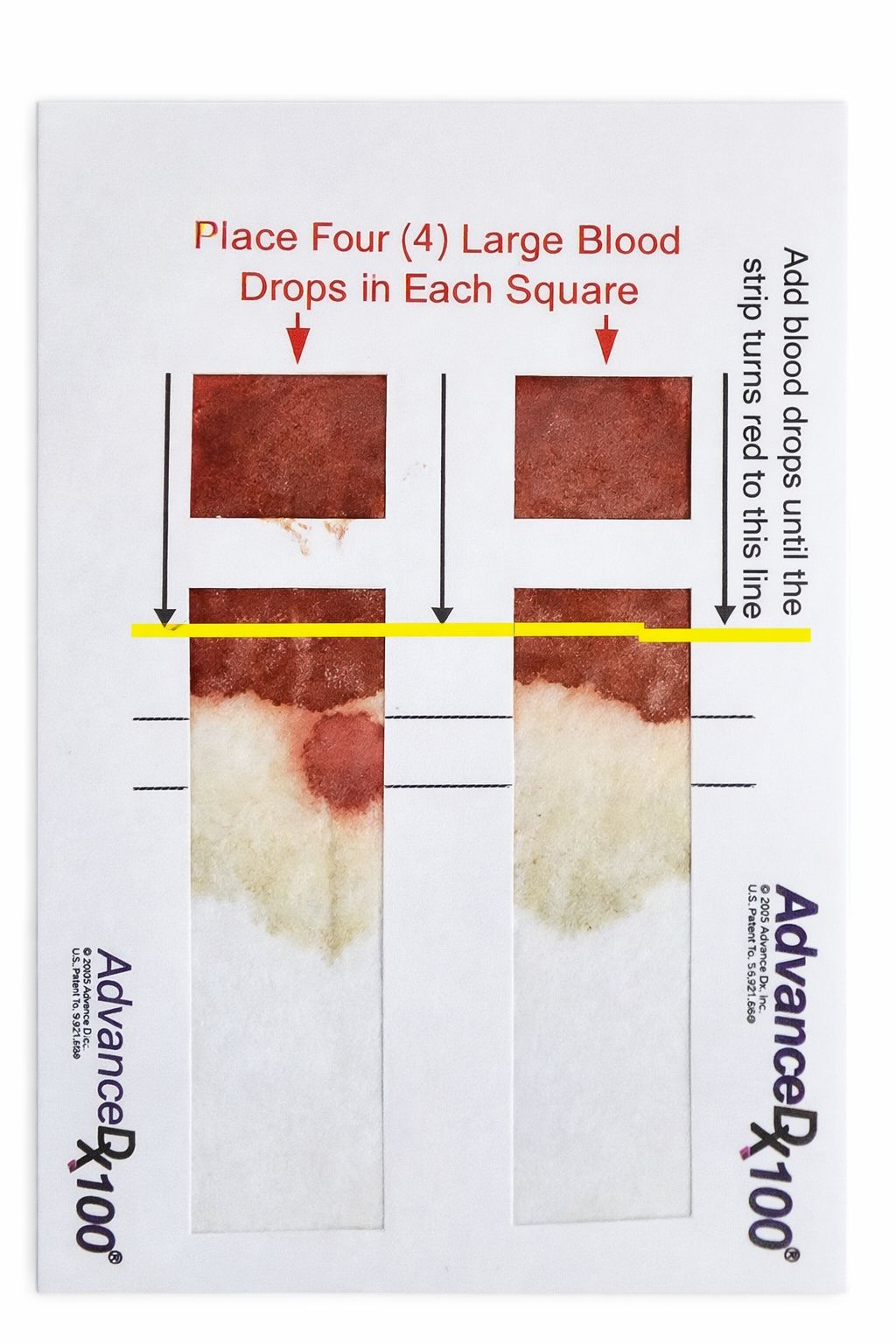 Correctly filled blood card — blood has spread past the first black line into the rectangles